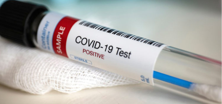 cannabis-start-up-develops-covid-19-testing123-that-can-sensors-within-minutes
